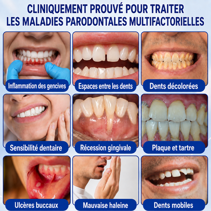 🇫🇷⚡GarageLine® GumRevive – Le Gel Avancé pour des Gencives Plus Saines et un Sourire Éclatant