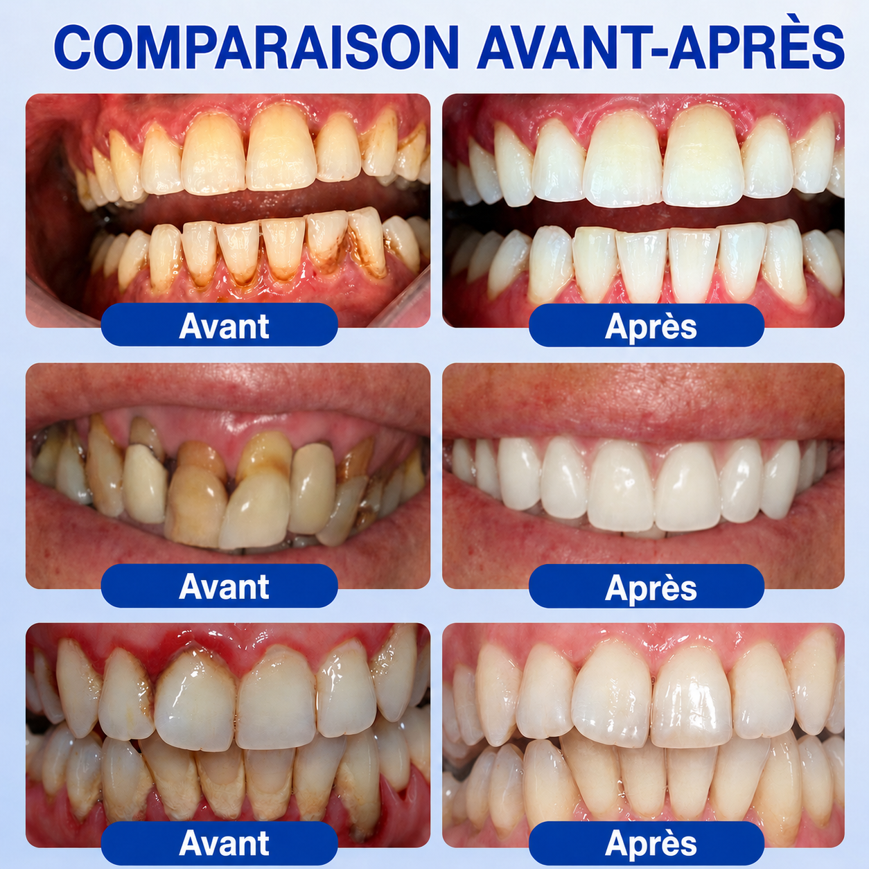🇫🇷⚡GarageLine® GumRevive – Le Gel Avancé pour des Gencives Plus Saines et un Sourire Éclatant