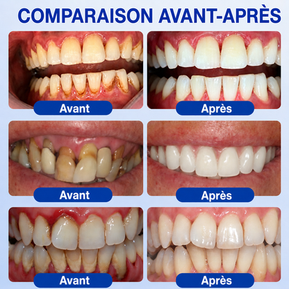 🇫🇷⚡GarageLine® GumRevive – Le Gel Avancé pour des Gencives Plus Saines et un Sourire Éclatant