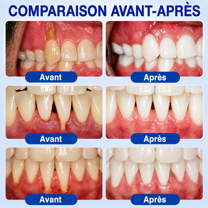 🇫🇷⚡GarageLine® GumRevive – Le Gel Avancé pour des Gencives Plus Saines et un Sourire Éclatant