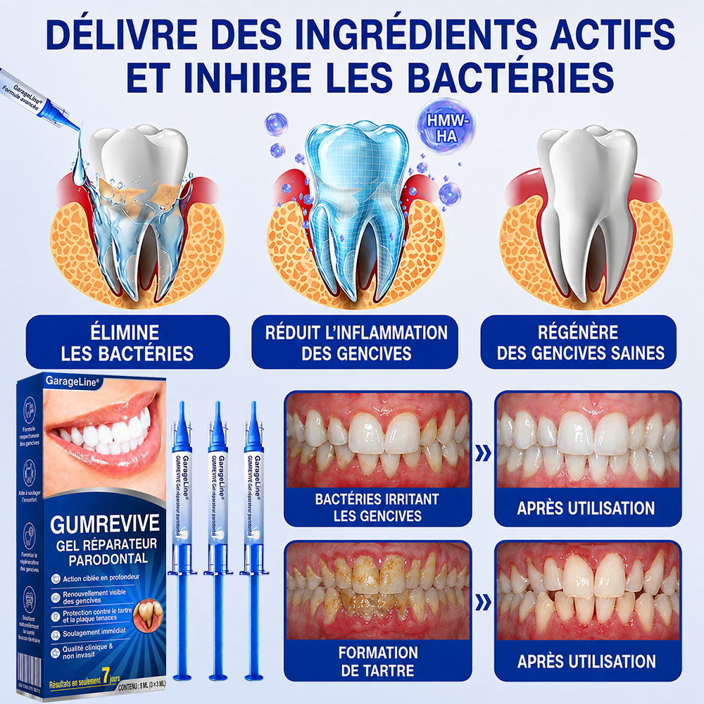 🇫🇷⚡GarageLine® GumRevive – Le Gel Avancé pour des Gencives Plus Saines et un Sourire Éclatant